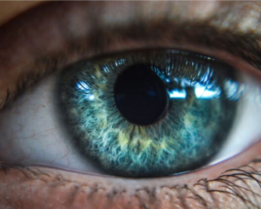 vision 2
